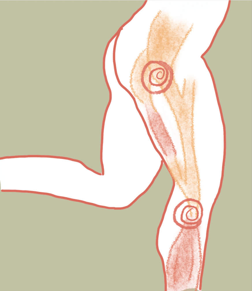 運動科學-跑步-外側膝頭痛-ITBS-髂脛束症候群
