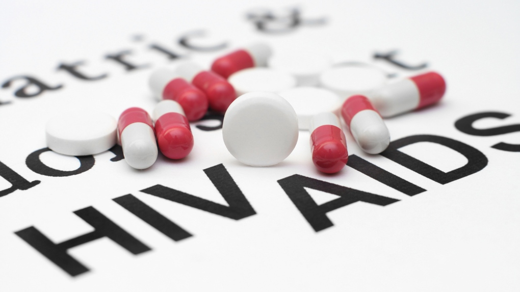 治未病-醫療專科-養和醫院-愛滋病-愛滋病病毒測試