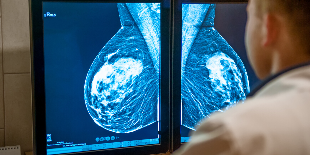健康-醫療科技-癌症-乳癌檢查-乳房x光造影-超聲波檢查